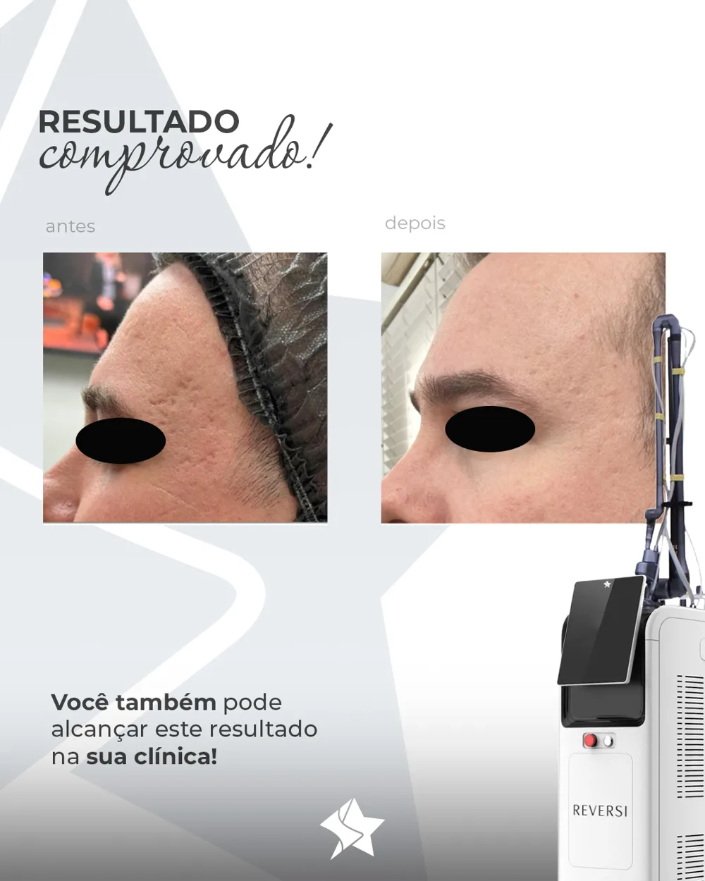 Antes e depois Reversi caso 1